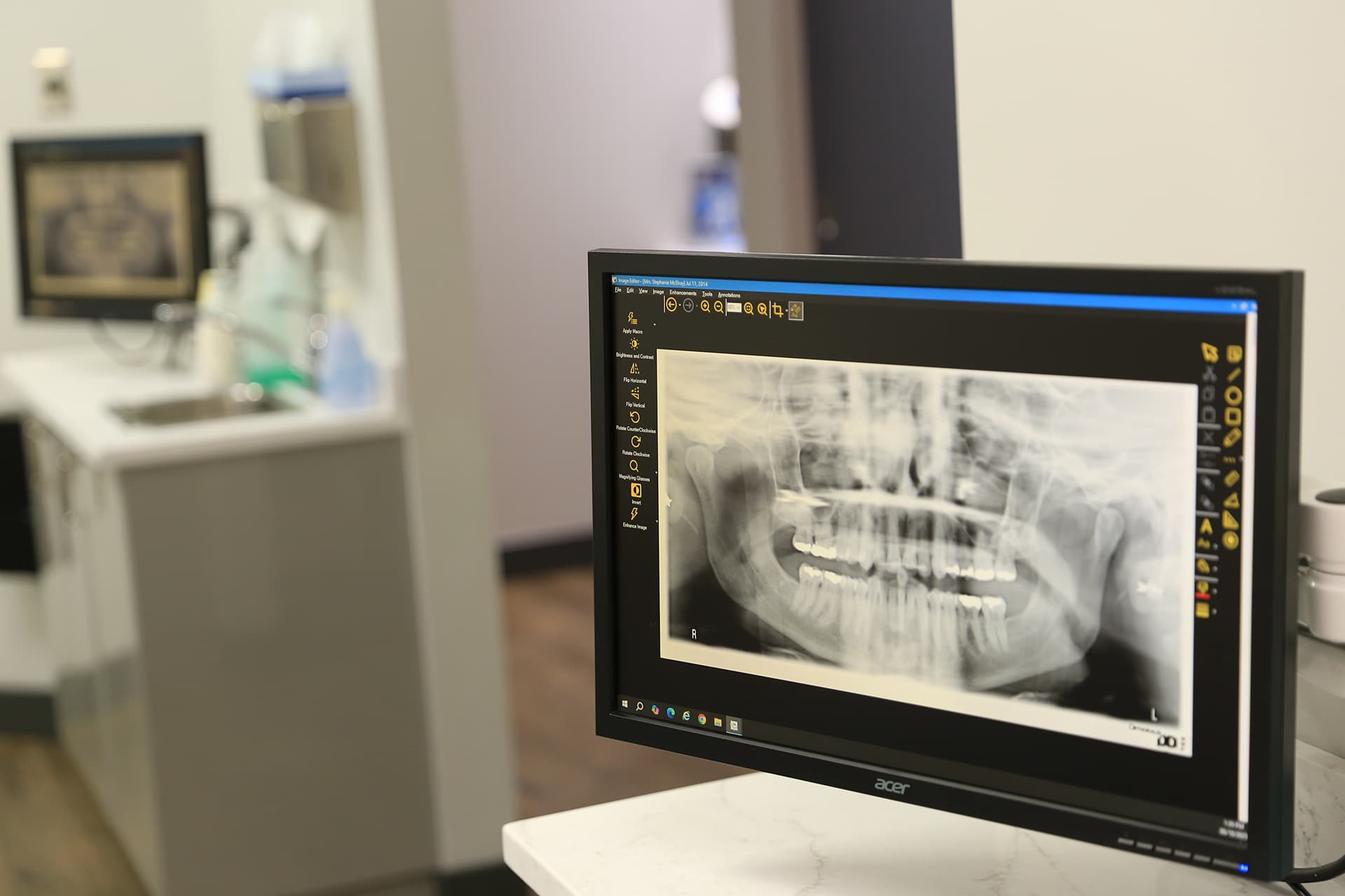 Dental X-Rays - Pitt Meadows